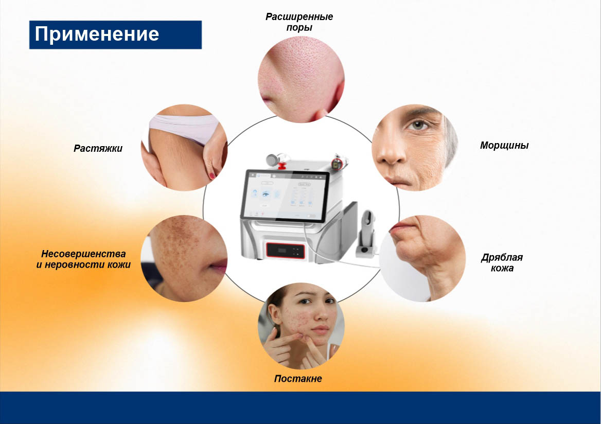 Области применения и результаты Области применения и результаты